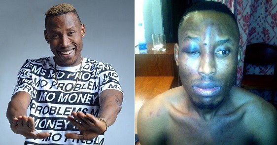 Singer, Mr 2Kay robbed at gunpoint in hotel room