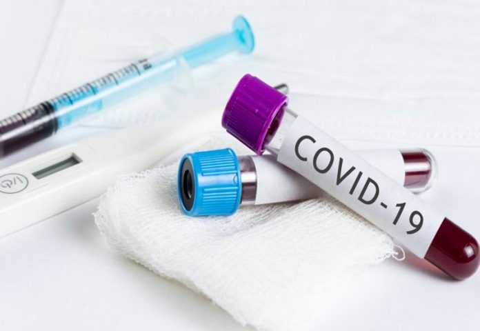 Nigeria’s COVID-19 Cases Rise By 163 to 60, 266