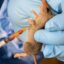 Lassa fever, meningitis kill 366 in 24 states – NCDC